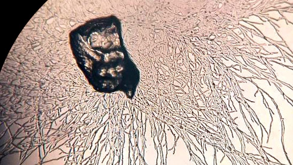 Scientists discover a fungus that can help eliminate plastic waste